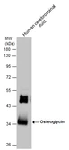 Anti-Osteoglycin antibody used in Western Blot (WB). GTX130841